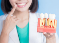 имплантация зубы