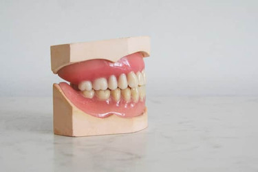 зубы протезирование